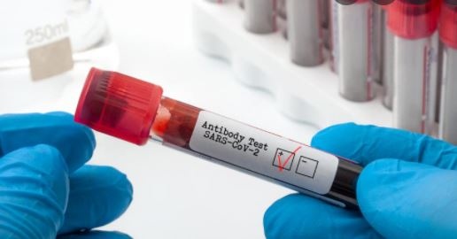 Новите случаи за последното денонощие са 346 Направените тестове за